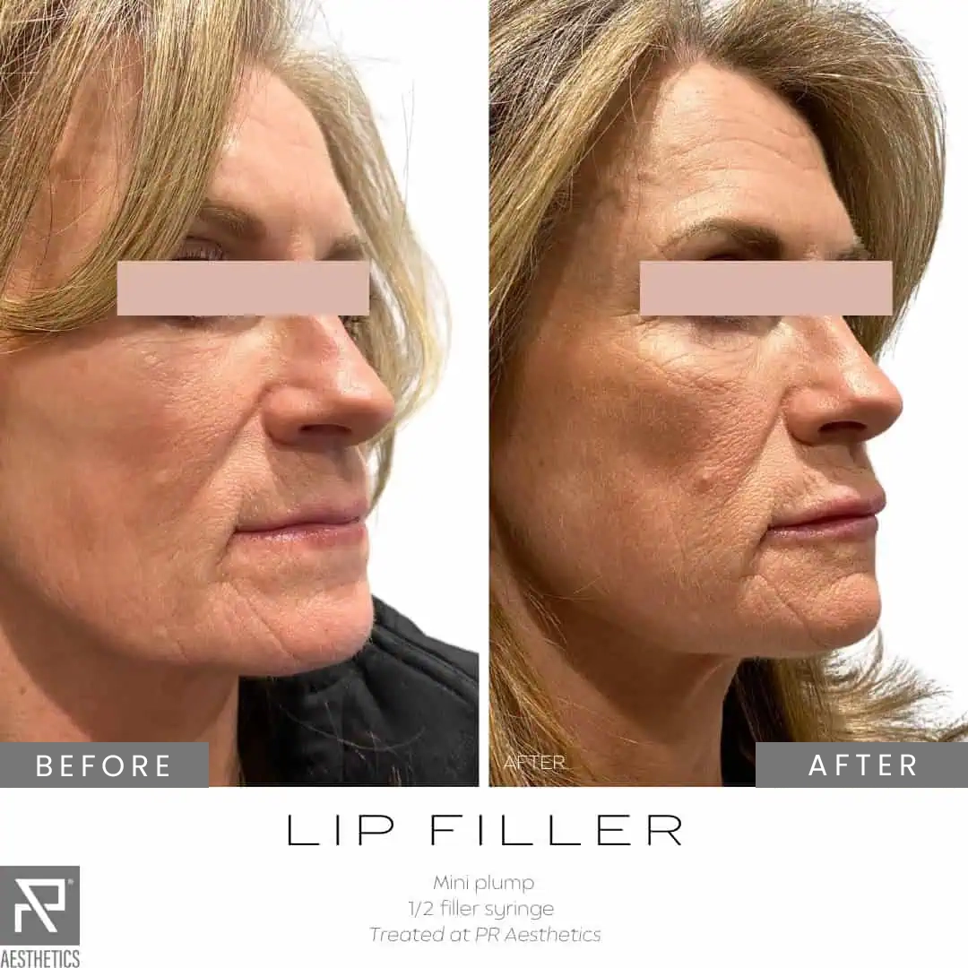 Before & After Images praesthetics (10)