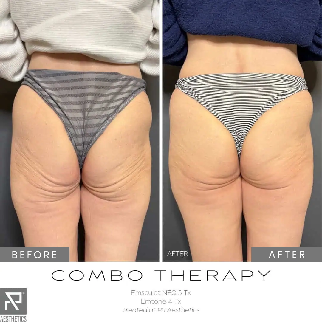 Before & After Images praesthetics (11)