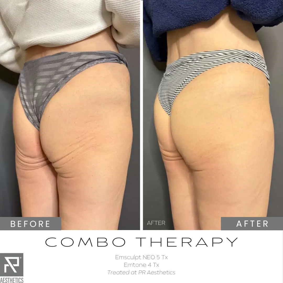 Before & After Images praesthetics (12)