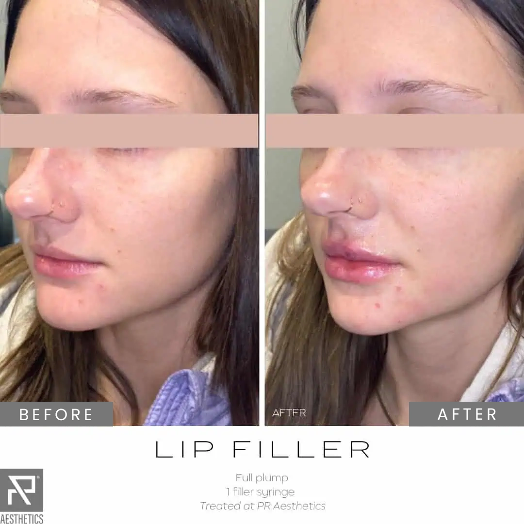 Before & After Images praesthetics (13)