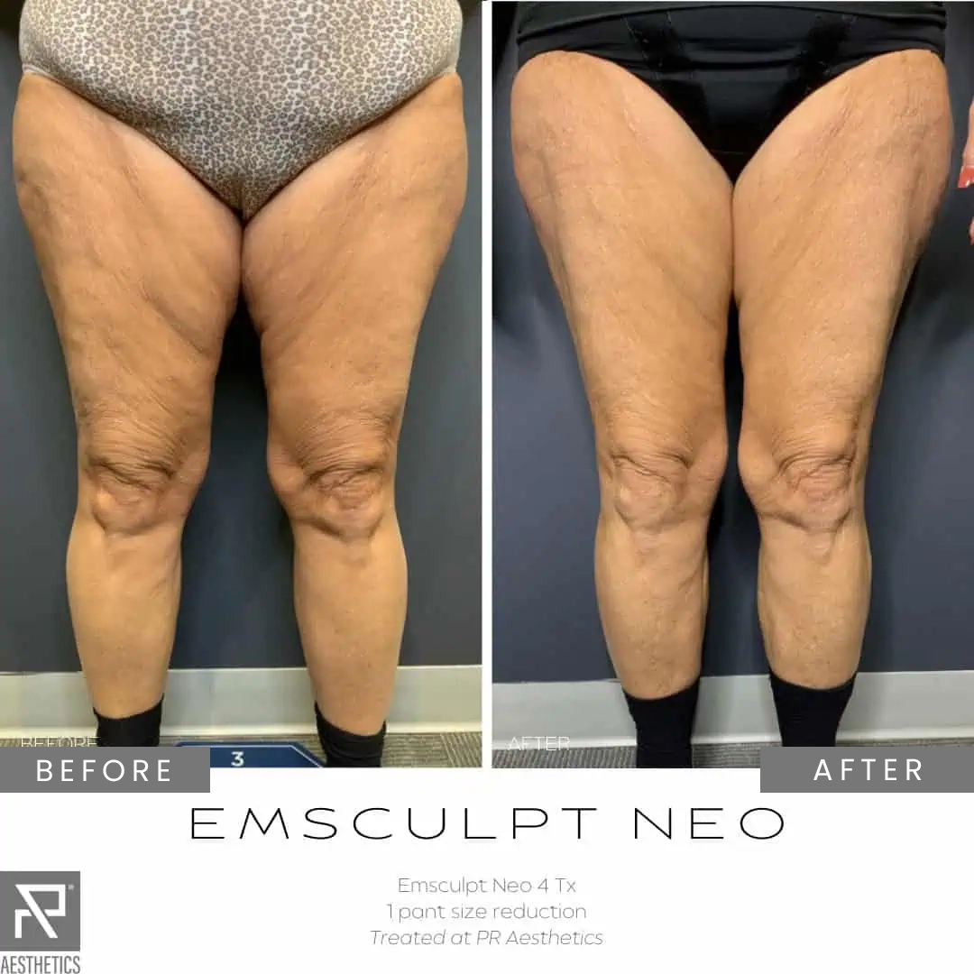 Before & After Images praesthetics (14)