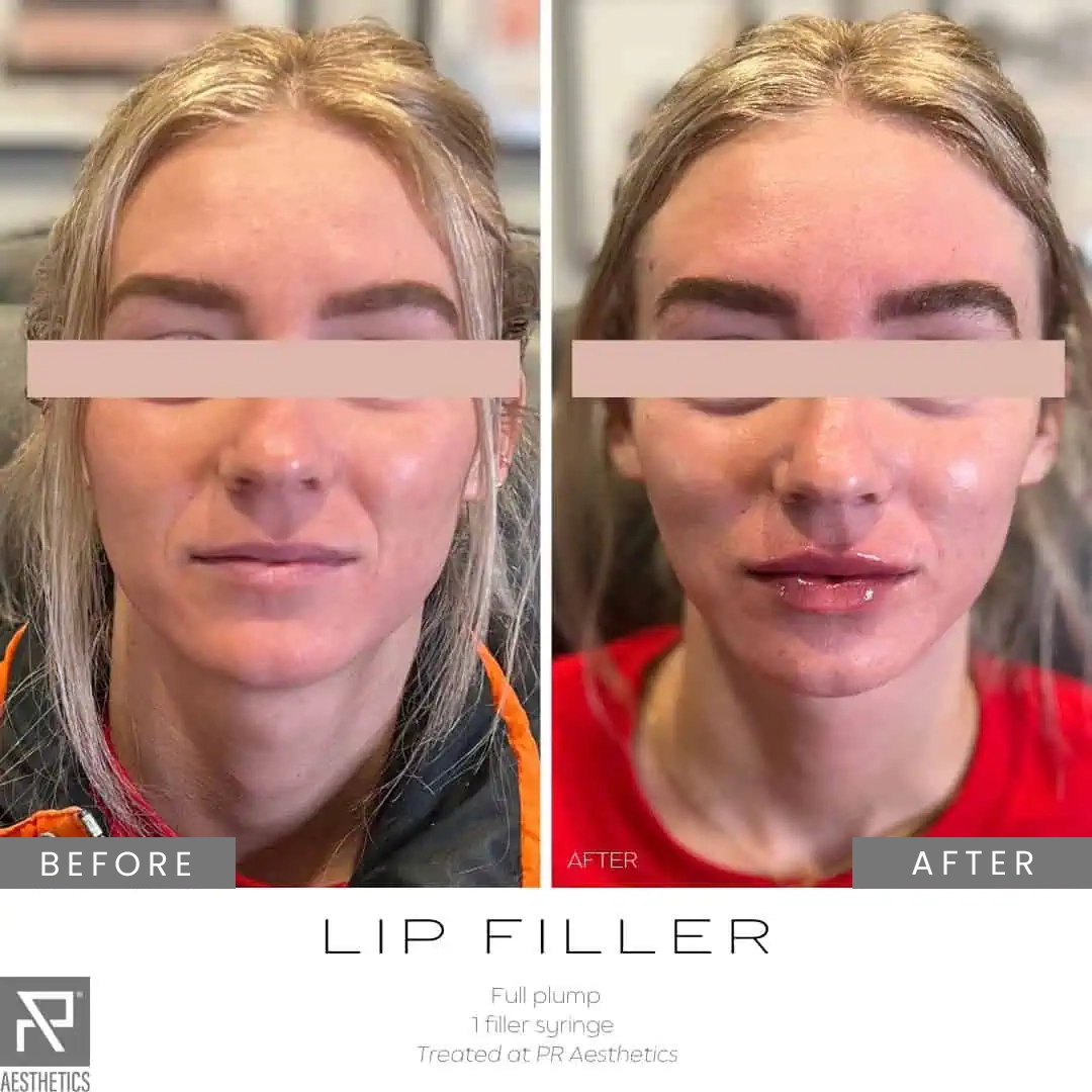 Before & After Images praesthetics (15)