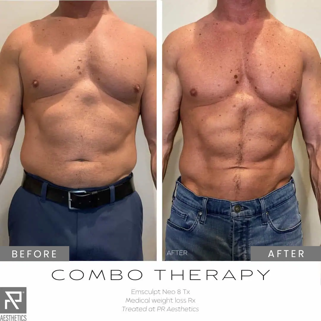 Before & After Images praesthetics (16)