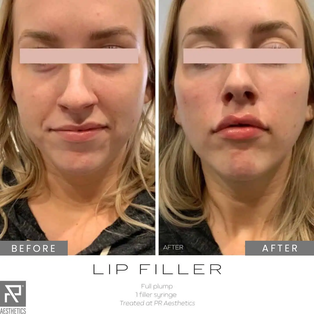 Before & After Images praesthetics (17)