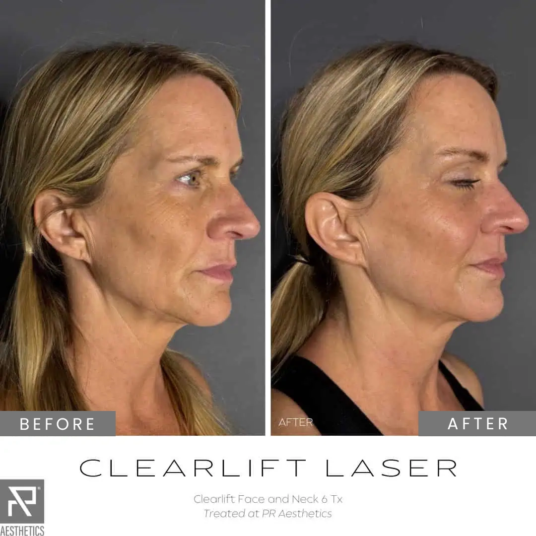 Before & After Images praesthetics (18)
