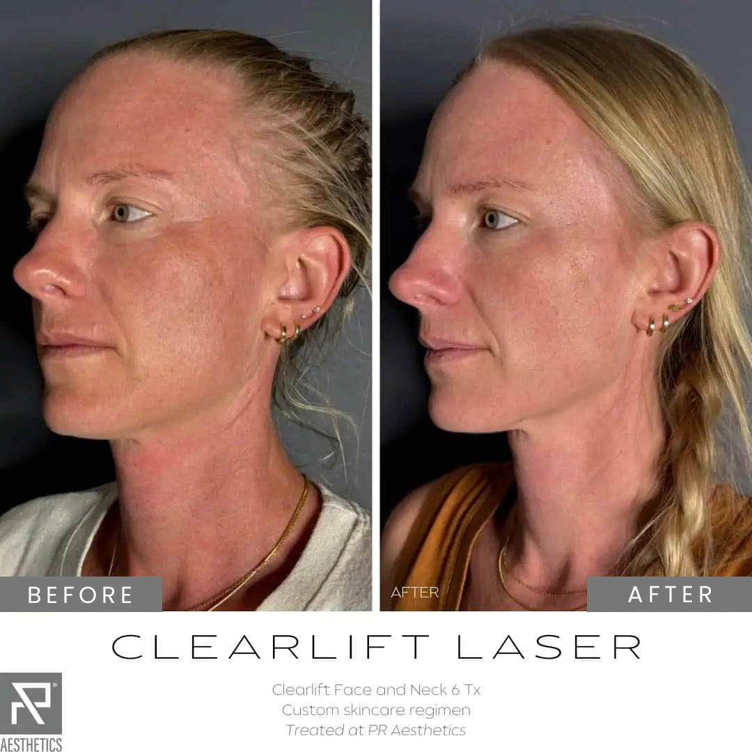 Before & After Images praesthetics (19)