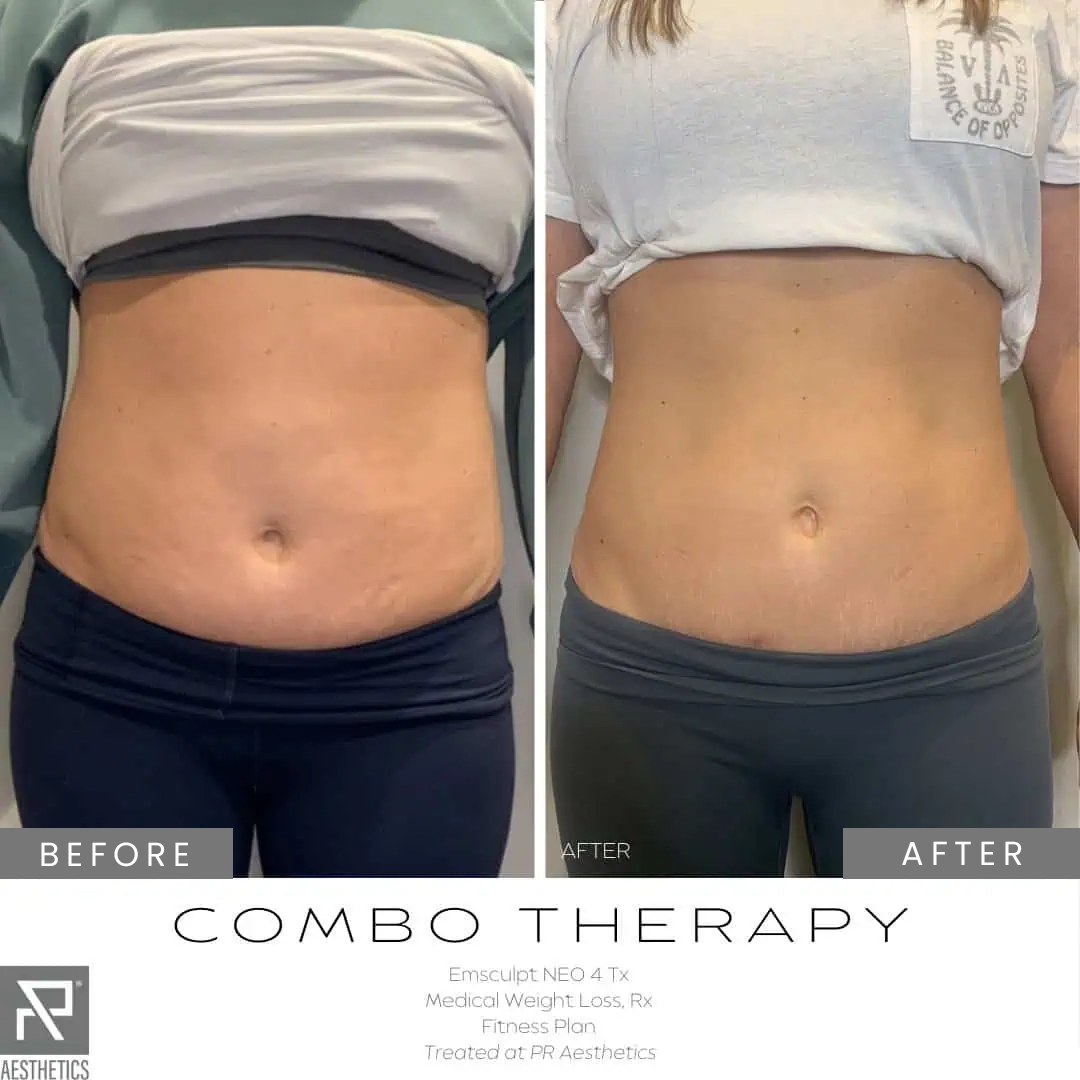 Before & After Images praesthetics (2)