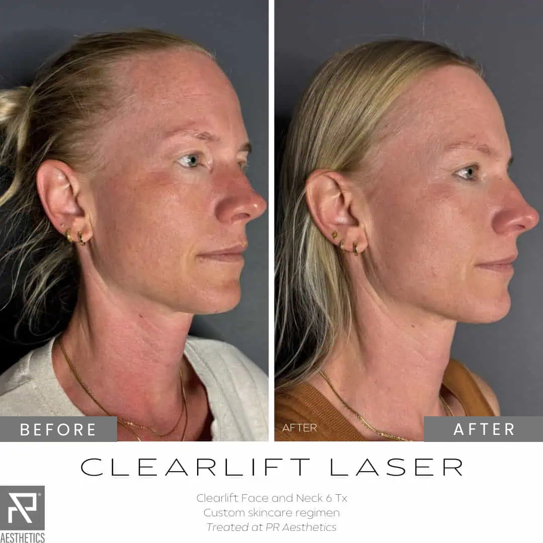 Before & After Images praesthetics (20)