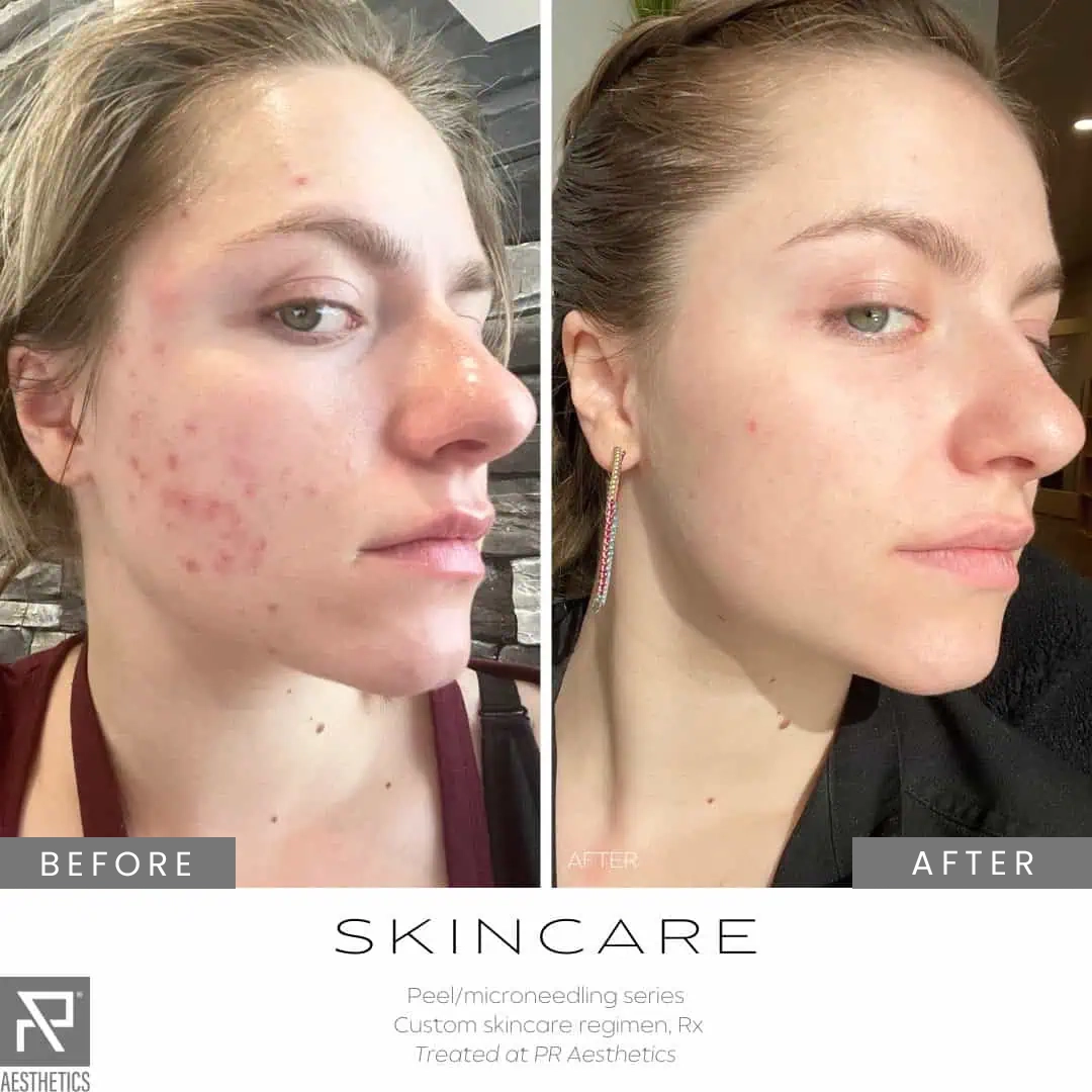 Before & After Images praesthetics (22)