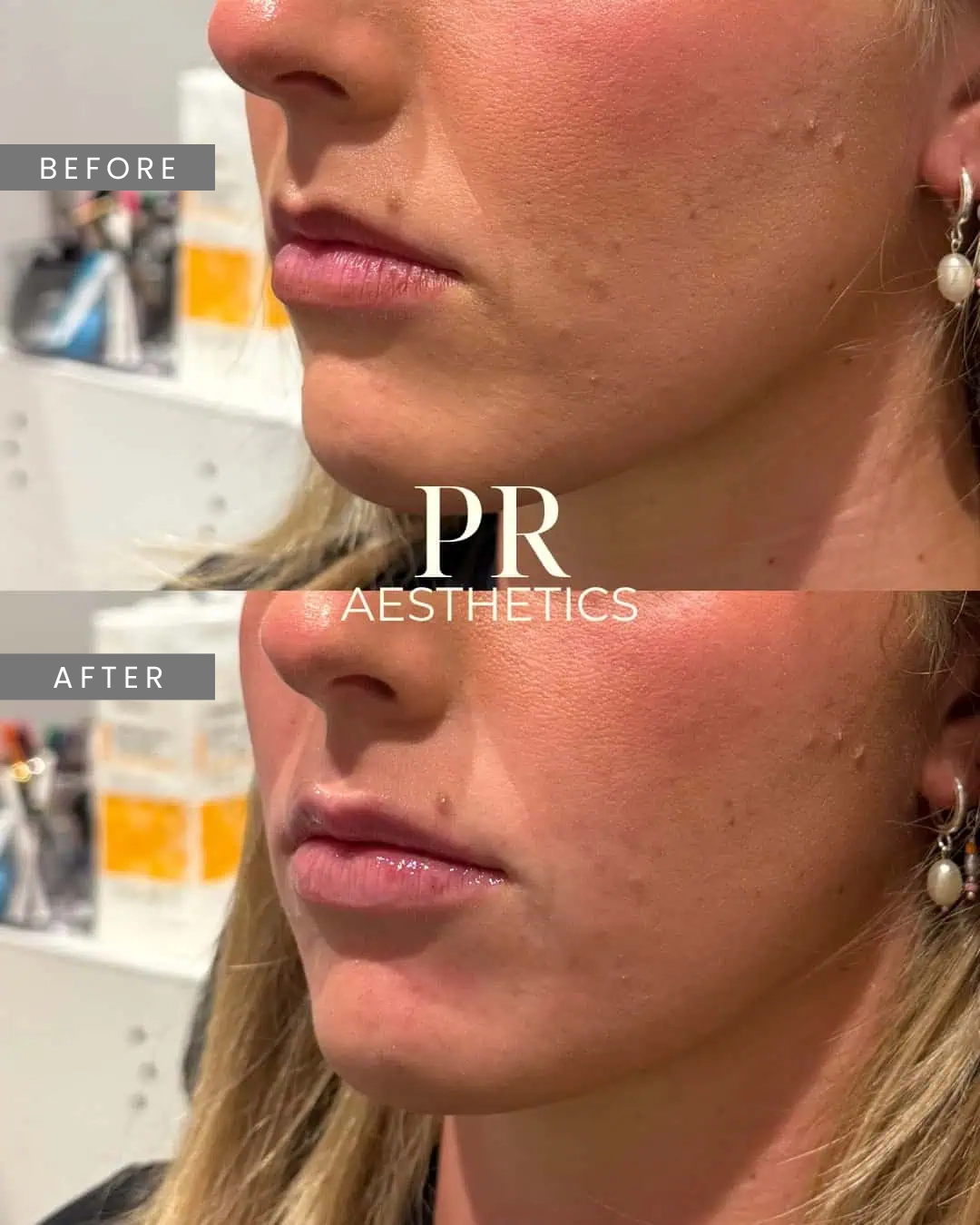 Before & After Images praesthetics (25)