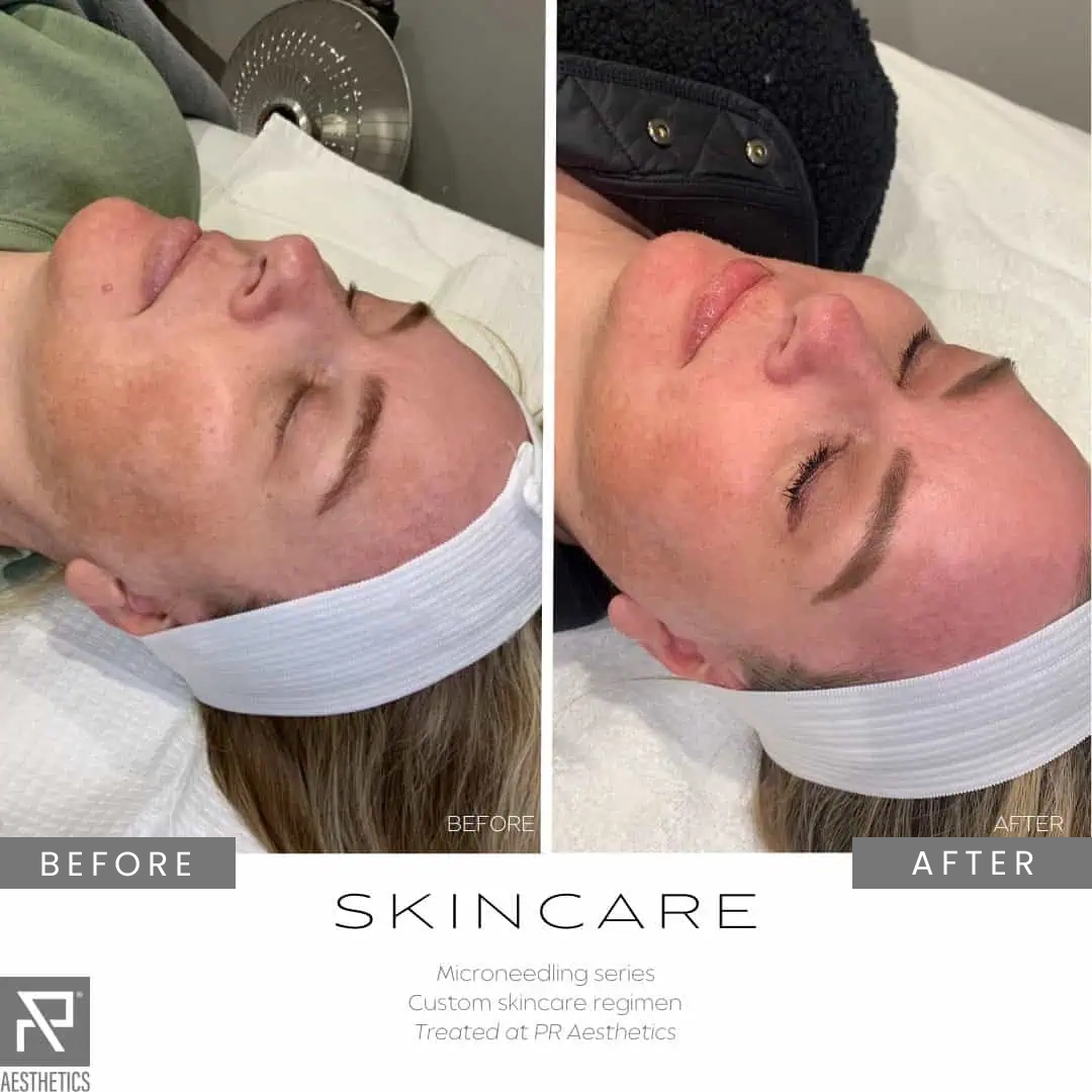 Before & After Images praesthetics (26)