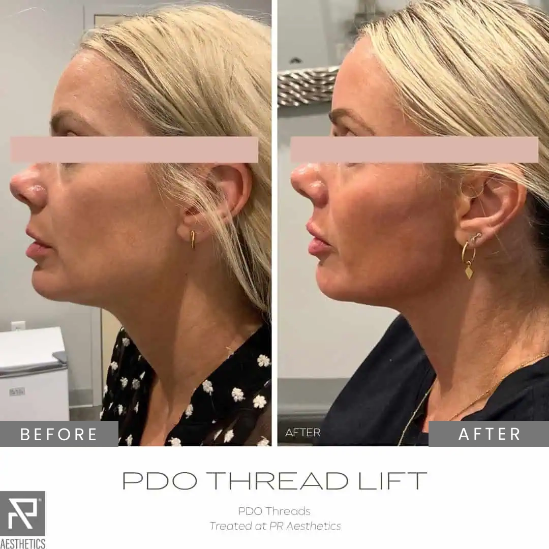 Before & After Images praesthetics (27)