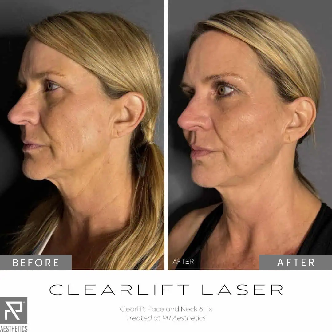 Before & After Images praesthetics (28)