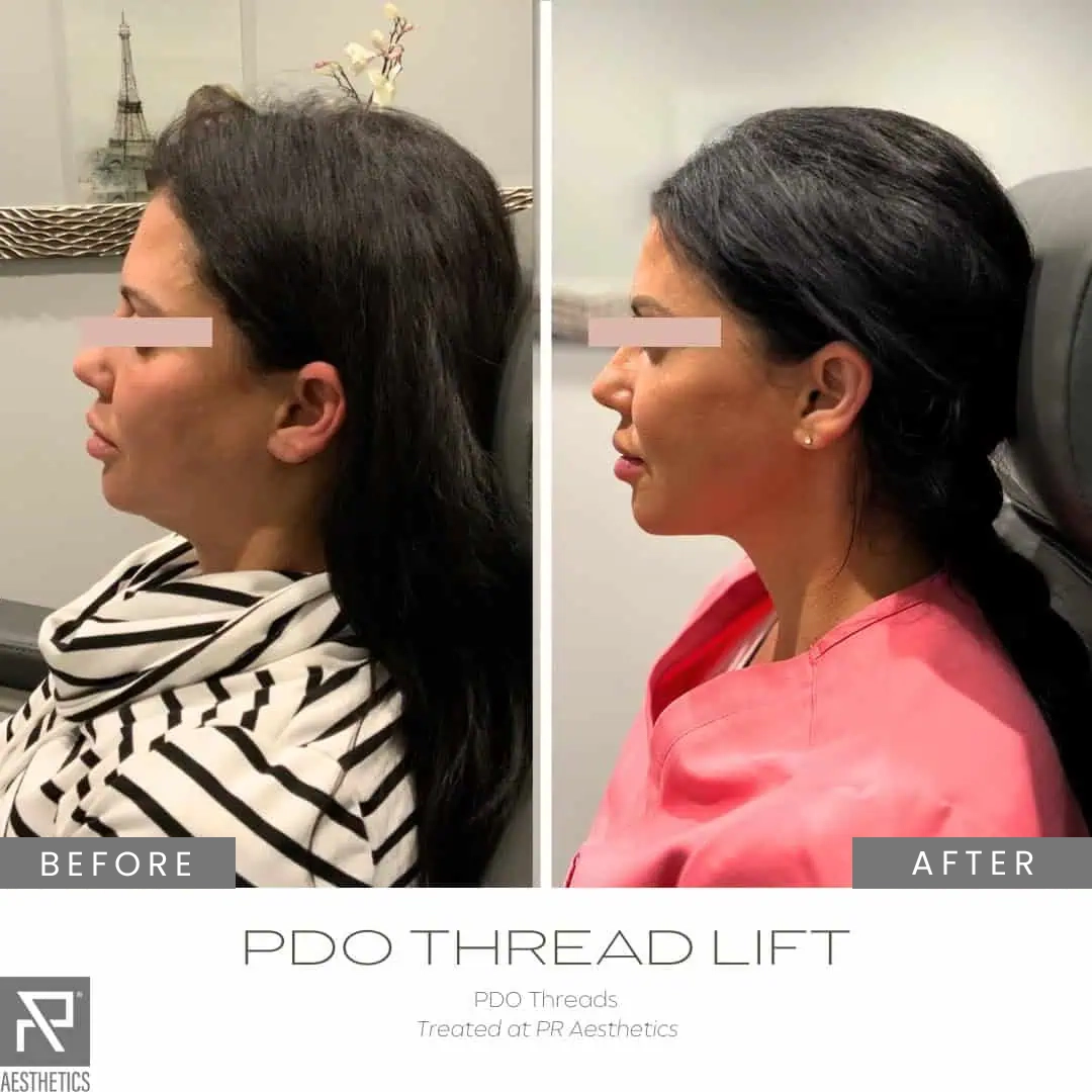 Before & After Images praesthetics (29)