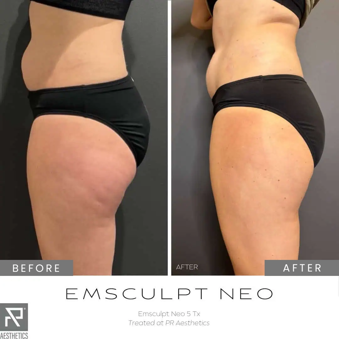 Before & After Images praesthetics (4)