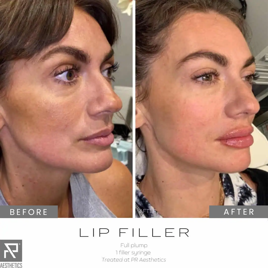 Before & After Images praesthetics (5)