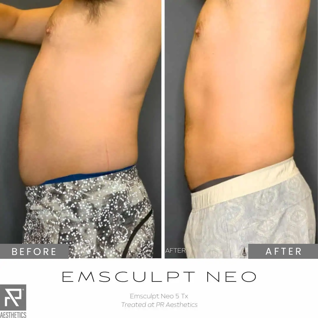 Before & After Images praesthetics (6)