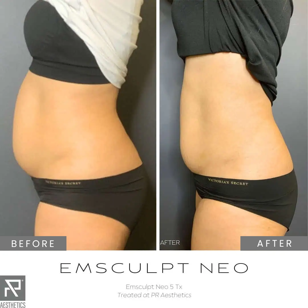 Before & After Images praesthetics (7)