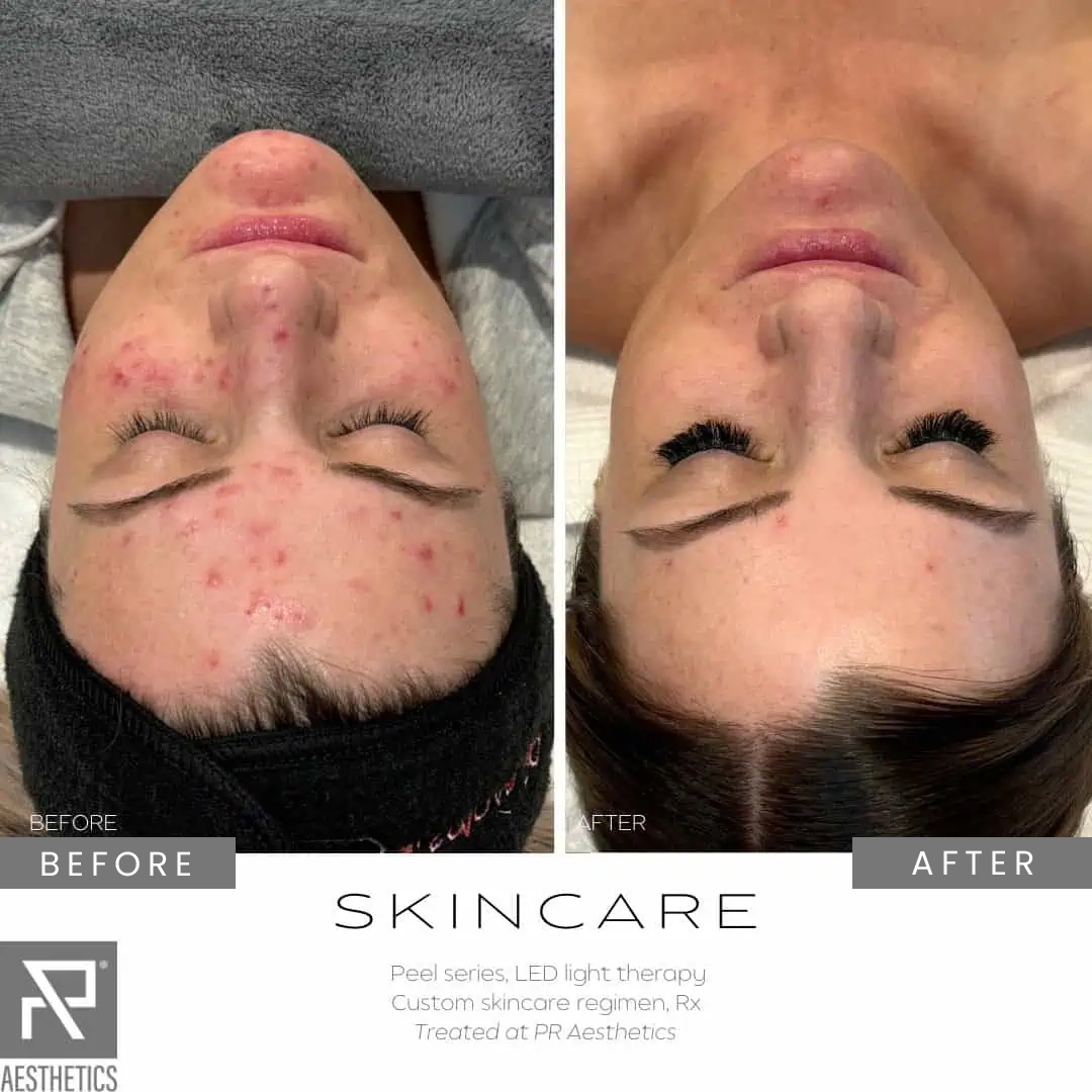 Before & After Images praesthetics (9)