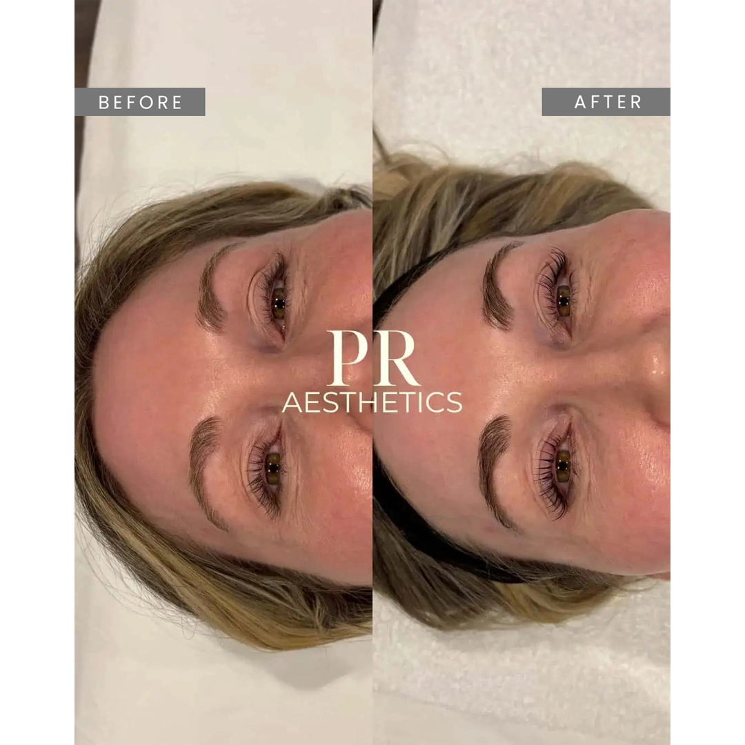Before & After Images praesthetics (24)