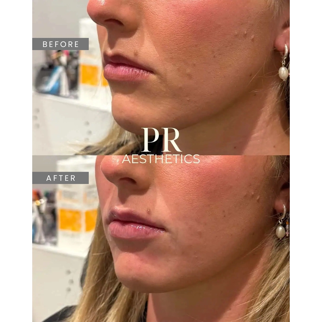 Before & After Images praesthetics (25)
